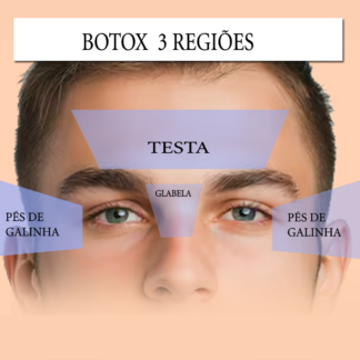 Botox Premium - Três Regiões ( Testa, glabela e periorbicular (pés de galinha))